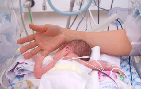Newborn in neonatal intensive care unit (NICU).